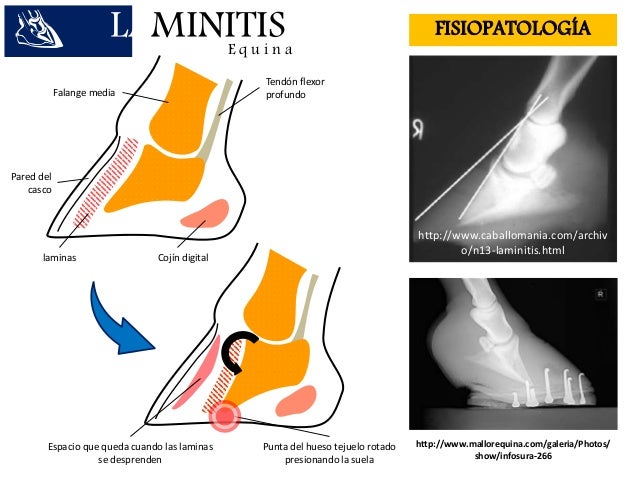laminitis equina